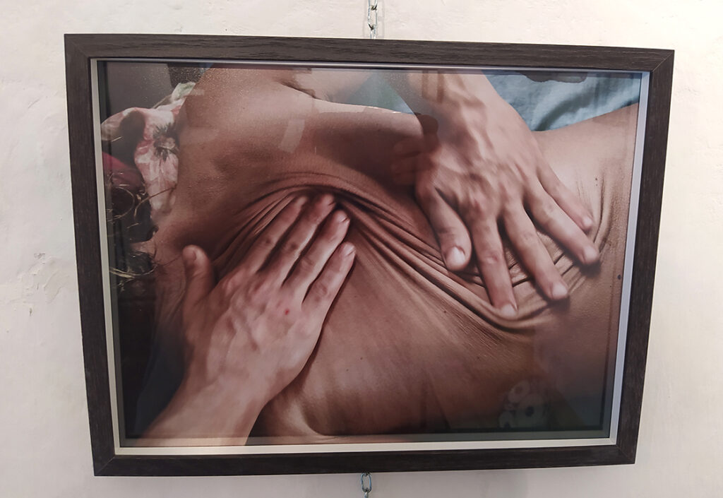 kintsugi: aranyozott sebhelyek